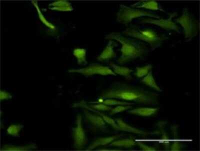 Immunocytochemistry/Immunofluorescence: TRIM35 Antibody [H00023087-D01P] - Analysis of antibody to TRIM35 on HeLa cell. Antibody concentration 30 ug/ml.