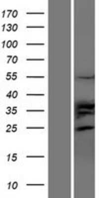 Western Blot: TRIM35 Overexpression Lysate (Adult Normal) [NBP2-05183] Left-Empty vector transfected control cell lysate (HEK293 cell lysate); Right -Over-expression Lysate for TRIM35.