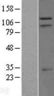 Western Blot: TRIM37 Overexpression Lysate (Adult Normal) [NBP2-09094] Left-Empty vector transfected control cell lysate (HEK293 cell lysate); Right -Over-expression Lysate for TRIM37.