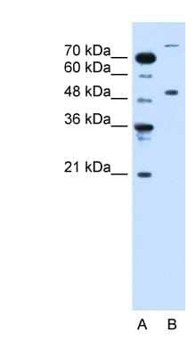 Western Blot: TRIM42 Antibody [NBP1-55074] - Jurkat cell lysate, concentration 0.2-1 ug/ml.