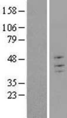 Western Blot: TRIM43 Overexpression Lysate (Adult Normal) [NBL1-17298] Left-Empty vector transfected control cell lysate (HEK293 cell lysate); Right -Over-expression Lysate for TRIM43.