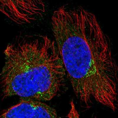 Immunocytochemistry/Immunofluorescence: TRIM44 Antibody [NBP2-55318] - Staining of human cell line HeLa shows localization to vesicles.