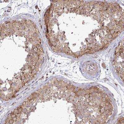 Immunohistochemistry-Paraffin: TRIM44 Antibody [NBP2-31681] - Staining of human testis shows moderate cytoplasmic positivity in cells in seminiferus ducts.