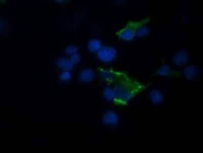 Immunocytochemistry/Immunofluorescence: TRIM44 Antibody (OTI1E10) - Azide and BSA Free [NBP2-74611] - Analysis of COS7 cells transiently transfected by pCMV6-ENTRY TRIM44.