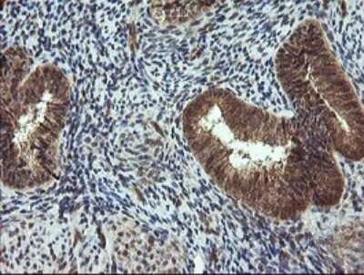 Immunohistochemistry: TRIM44 Antibody (OTI1E10) - Azide and BSA Free [NBP2-74611] - Analysis of Human endometrium tissue.