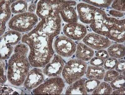 Immunohistochemistry: TRIM44 Antibody (OTI1E10) - Azide and BSA Free [NBP2-74611] - Analysis of Human Kidney tissue.
