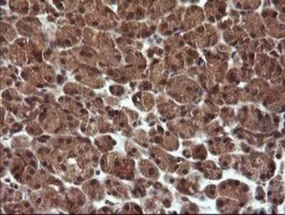 Immunohistochemistry: TRIM44 Antibody (OTI1E10) - Azide and BSA Free [NBP2-74611] - Analysis of Human pancreas tissue.