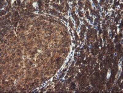 Immunohistochemistry: TRIM44 Antibody (OTI1E10) - Azide and BSA Free [NBP2-74611] - Analysis of Human tonsil tissue.