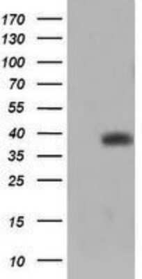 Western Blot: TRIM44 Antibody (OTI1E10) - Azide and BSA Free [NBP2-74611] - Analysis of HEK293T cells were transfected with the pCMV6-ENTRY control (Left lane) or pCMV6-ENTRY TRIM44.