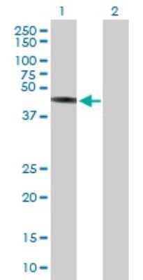 Western Blot: TRIM44 Antibody [H00054765-B01P] - Analysis of TRIM44 expression in transfected 293T cell line by TRIM44 polyclonal antibody.  Lane 1: TRIM44 transfected lysate(37.84 KDa). Lane 2: Non-transfected lysate.