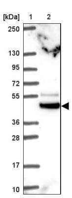 Western Blot TRIM44 Antibody - BSA Free