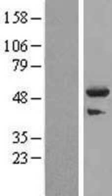 Western Blot TRIM44 Overexpression Lysate