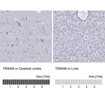 <b>Orthogonal Strategies Validation. </b>Immunohistochemistry-Paraffin: TRIM46 Antibody [NBP2-62626] - Immunohistochemistry analysis in human cerebral cortex and liver tissues using Anti-TRIM46 antibody. Corresponding TRIM46 RNA-seq data are presented for the same tissues.