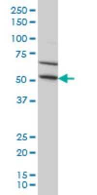 Western Blot: TRIM49 Antibody (3H8) [H00057093-M03] - Analysis of TRIM49 expression in HeLa (Cat # L013V1).