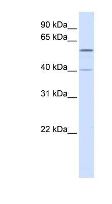 Western Blot: TRIM49 Antibody [NBP1-55061] - Human Liver cell lysate, concentration 0.2-1 ug/ml.