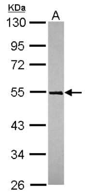 Western Blot TRIM49 Antibody