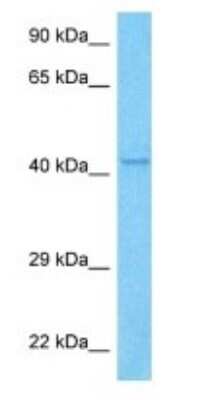 Western Blot: TRIM49B Antibody [NBP3-09223] - Western blot analysis of TRIM49B in A549 Whole Cell lysates. Antibody dilution at 1.0ug/ml