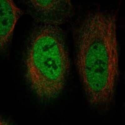 Immunocytochemistry/Immunofluorescence: TRIM49D1 Antibody [NBP3-17183] - Staining of human cell line U-2 OS shows localization to nucleoplasm & cytosol.