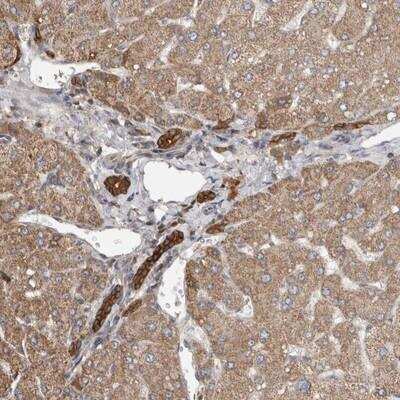 Immunohistochemistry: TRIM5 Antibody [NBP1-87120] - Staining of human liver shows strong positivity in bile duct cells.