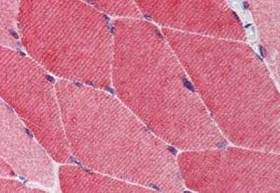 Immunohistochemistry-Paraffin: TRIM5 Antibody [NBP1-52454] - Analysis of anti-TRIM5 antibody with human skeletal muscle at concentration 5 ug/ml.