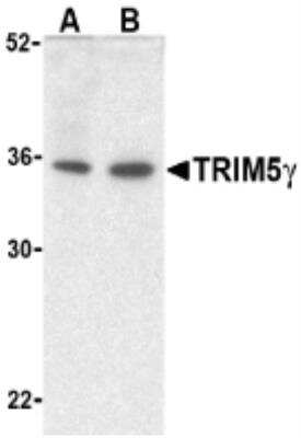 Western Blot: TRIM5 Antibody [NBP1-52607] - Western blot of TRIM5 expression in human bladder (A) and colon (B) cell lysate with TRIM5 antibody at 2 ug /ml.