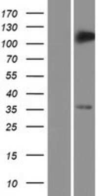 Western Blot: TRIM5 Overexpression Lysate (Adult Normal) [NBP2-09940] Left-Empty vector transfected control cell lysate (HEK293 cell lysate); Right -Over-expression Lysate for TRIM5.