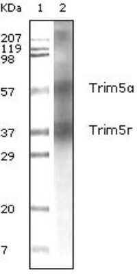 Western Blot: TRIM5 alpha Antibody (3B11H2) [NB100-2192] - Analysis using Trim5a mouse mAb against human breast carcinoma tissue lysate.
