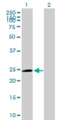 Western Blot TRIM50C Antibody - Azide and BSA Free