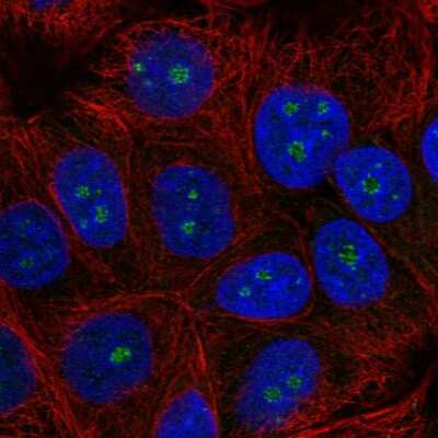 Immunocytochemistry/Immunofluorescence: TRIM52 Antibody [NBP2-56725] - Staining of human cell line MCF7 shows localization to nucleoli fibrillar center.