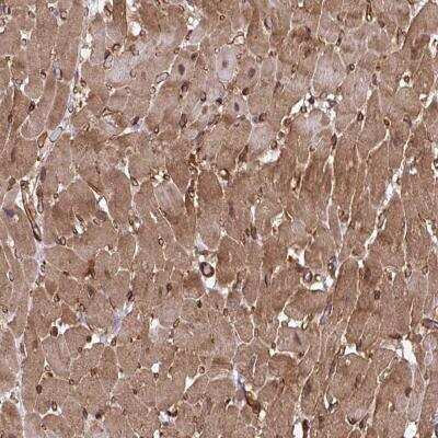 Immunohistochemistry-Paraffin: TRIM52 Antibody [NBP2-31651] - Staining of human heart muscle shows moderate cytoplasmic positivity in myocytes.