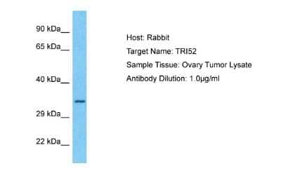 Western Blot: TRIM52 Antibody [NBP2-88476] - Host: Rabbit. Target Name: TRI52. Sample Type: Ovary Tumor lysates. Antibody Dilution: 1.0ug/ml