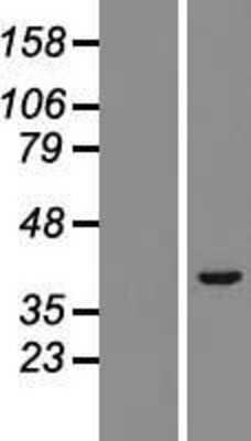 Western Blot: TRIM52 Overexpression Lysate (Adult Normal) [NBL1-17304] Left-Empty vector transfected control cell lysate (HEK293 cell lysate); Right -Over-expression Lysate for TRIM52.