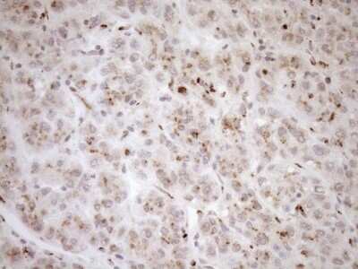 Immunohistochemistry: TRIM56 Antibody (5A1) [NBP2-46232] - Analysis of Human liver tissue. (Heat-induced epitope retrieval by 1mM EDTA in 10mM Tris buffer (pH8.5) at 120C for 3 min)