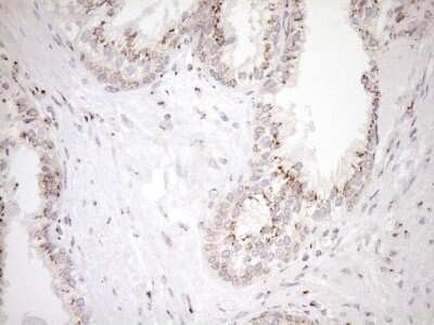 Immunohistochemistry: TRIM56 Antibody (5A1) [NBP2-46232] - Analysis of Human prostate tissue within the normal limits using TRIM56 mouse monoclonal antibody. (Heat-induced epitope retrieval by 1mM EDTA in 10mM Tris buffer (pH8.5) at 120C for 3 min)(1:150)