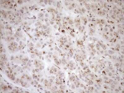 Immunohistochemistry: TRIM56 Antibody (OTI5A1) - Azide and BSA Free [NBP2-74613] - Analysis of Human liver tissue. (Heat-induced epitope retrieval by 1mM EDTA in 10mM Tris buffer (pH8.5) at 120C for 3 min)
