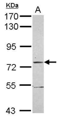 Western Blot: TRIM56 Antibody [NBP2-20722] - Sample (30 ug of whole cell lysate) A: 293T 7. 5% SDS PAGE gel, diluted at 1:1000.