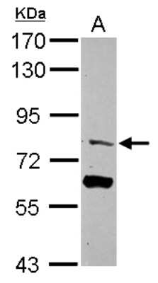 Western Blot: TRIM56 Antibody [NBP2-20723] - Sample (30 ug of whole cell lysate) A: 293T 7. 5% SDS PAGE gel, diluted at 1:1000.