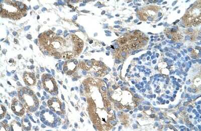 Immunohistochemistry-Paraffin TRIM59 Antibody