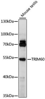 Western Blot: TRIM60 Antibody [NBP2-94453] - Analysis of extracts of mouse testis, using TRIM60 at 1000 dilution.Secondary antibody: HRP Goat Anti-Rabbit IgG (H+L) at 1:10000 dilution.Lysates/proteins: 25ug per lane.Blocking buffer: 3% nonfat dry milk in TBST.Detection: ECL Basic Kit .Exposure time: 90s.