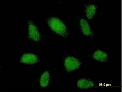 Immunocytochemistry/Immunofluorescence: TRIM62 Antibody [H00055223-B01P] - Analysis of purified antibody to TRIM62 on HeLa cell. (antibody concentration 10 ug/ml)