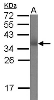 Western Blot: TRIM62 Antibody [NBP2-15144] - Antibody at 1:90000 dilution to detect 100ng of 37CDa recombinant TRIM62 protein antigen.