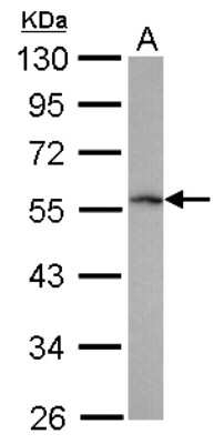 Western Blot: TRIM62 Antibody [NBP2-15144] - Sample (30 ug of whole cell lysate) A: A431 10% SDS PAGE; antibody diluted at 1:1000.