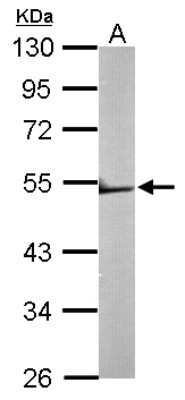 Western Blot: TRIM62 Antibody [NBP2-15145] - Sample (50 ug of whole cell lysate) A: Mouse brain 10% SDS PAGE; antibody diluted at 1:1000.