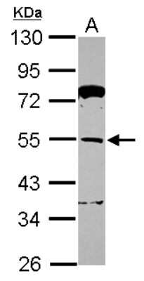 Western Blot: TRIM62 Antibody [NBP2-15145] - Sample (30 ug of whole cell lysate) A: Jurkat 10% SDS PAGE, antibody diluted at 1:500.