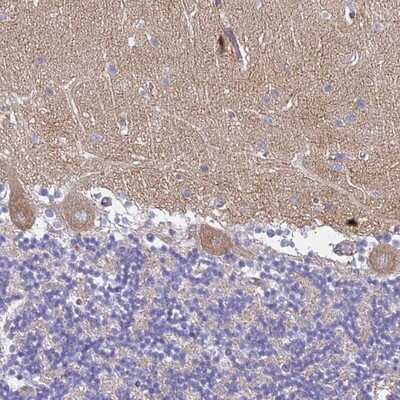 Immunohistochemistry-Paraffin: TRIM64A Antibody [NBP2-14548] - Staining of human cerebellum shows moderate cytoplasmic positivity in Purkinje cells.