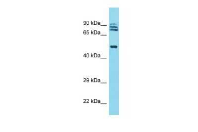 Western Blot: TRIM64A Antibody [NBP2-83713] - Host: Rabbit. Target Name: TRIM64. Sample Type: Fetal Lung lysates. Antibody Dilution: 1.0ug/ml