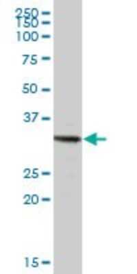 Western Blot: TRIM72 Antibody [H00493829-B01P] - Analysis of TRIM72 expression in human liver.