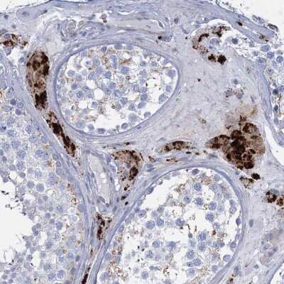 Immunohistochemistry: TRIM77 Antibody [NBP2-32617] - Staining of human testis shows strong cytoplasmic positivity in Leydig cells.