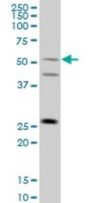 Western Blot: TRIML1 Antibody (4F8) [H00339976-M01] - FLJ36180 monoclonal antibody (M01), clone 4F8 Analysis of FLJ36180 expression in A-431.