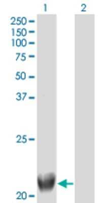 Western Blot: TRIML1 Antibody (4F8) [H00339976-M01] - Analysis of TRIML1 expression in transfected 293T cell line by FLJ36180 monoclonal antibody (M01), clone 4F8.Lane 1: TRIML1 transfected lysate(21.4 KDa).Lane 2: Non-transfected lysate.